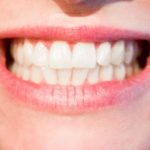 Mocne i zdrowe zęby – sposób na piękny uśmiech